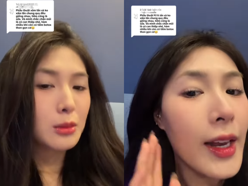 Quay trở lại với tin đồn PTTM, Quỳnh Alee nói: "Cái mũi này của mình là mũi thật, trời ơi, làm gì có mũi nào sửa mà thấp thế này. Và mặt mình không tiêm một chút filler nào hết. Không biết sao bạn lại khẳng định vậy".