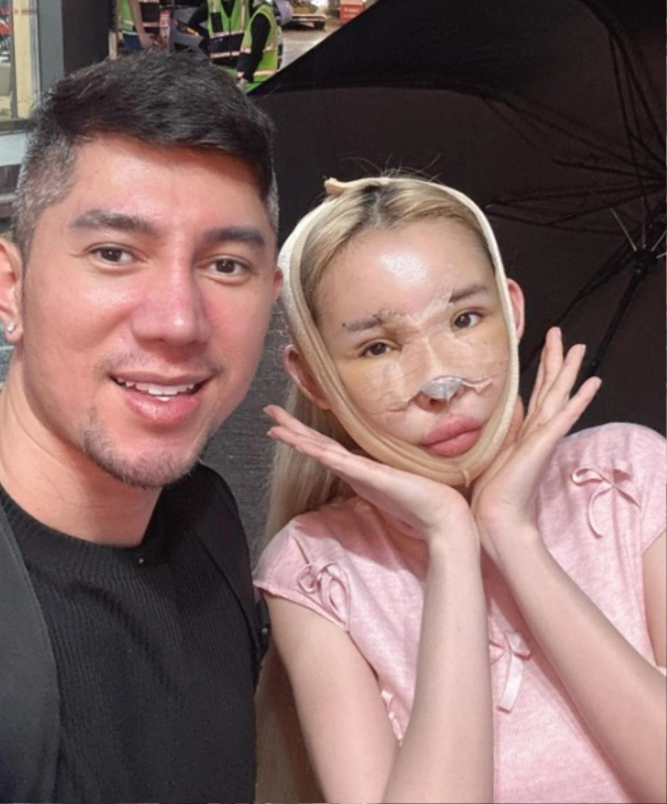 Sau 1 tháng qua Hàn phẫu thuật, nữ DJ gặp tình trạng đáng lo ở phần mũi.