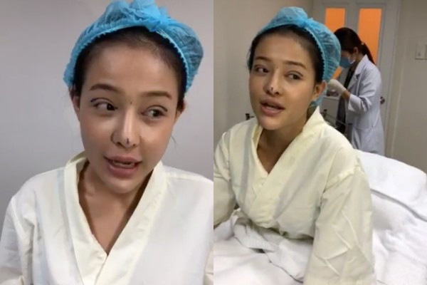Sắp tới, Ngân 98 sẽ phải tháo mũi giả, điều trị dứt điểm để hết tình trạng viêm rồi 3-4 tháng sau mới được thẩm mỹ trở lại.