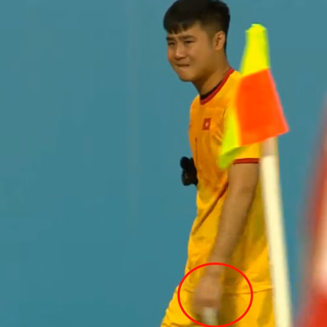 Cũng chính điểm tiếp xúc với trái bóng là ngón tay khiến Văn Toản gặp chấn thương và buộc phải rời sân.