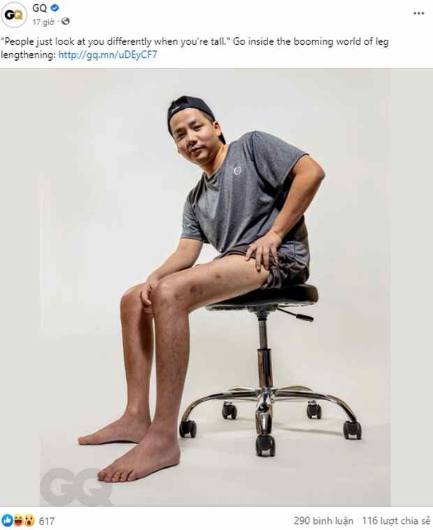 Mới đây, hình ảnh Khoa Pug kéo chân bất ngờ xuất hiện trên fanpage của tạp chí GQ Mỹ. Được biết, tạp chí GQ thành lập từ năm 1931, là tạp chí dành cho nam giới, được phát hành hàng tháng với đa dạng chủ đề như thời trang, phong cách, công nghệ, du lịch,... Tạp chí với tuổi đời gần 100 năm này quy tụ nhiều gương mặt ca sĩ, nghệ sĩ nổi tiếng trên thế giới xuất hiện trên trang bìa.