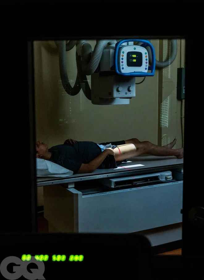 Ngoài ra, trong bài viết cũng đề cập đến các vấn đề kỹ thuật chuyên sâu của bác sĩ nổi tiếng về phẫu thuật kéo dài xương đùi, tăng chiều cao cho nam giới.