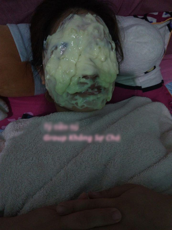 Cụ thể, nickname N.T.Đ có viết: "Em đi làm về muộn, bật điện lên thì thấy thế này các bác ạ. Em suy nghĩ xem có nên túm đấm cho trận hay không?".