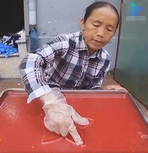 Cụ thể, bà Tân được tiêm tinh chất và tế bào gốc bằng các thiết bị làm đẹp tối tân để cải thiện sự thiếu hụt collagen.