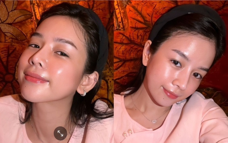 Đồng thời, đường nét gương mặt và sống mũi cao, thẳng sau 2 lần tân trang của DJ Mie cũng khiến fan xuýt xoa.