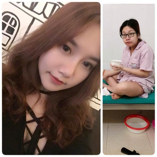 Đó là chưa kể đến, mang bầu có thể gây ra những vết rạn xấu xí trên da khó có thể xóa mờ.