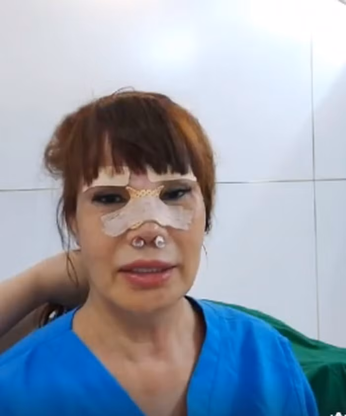 Bên cạnh đó, cô dâu 62 tuổi Thu Sao cũng tiết lộ sẽ làm thủ thuật kéo căng da mặt để bản thân được trẻ trung hơn trong tương lai gần.