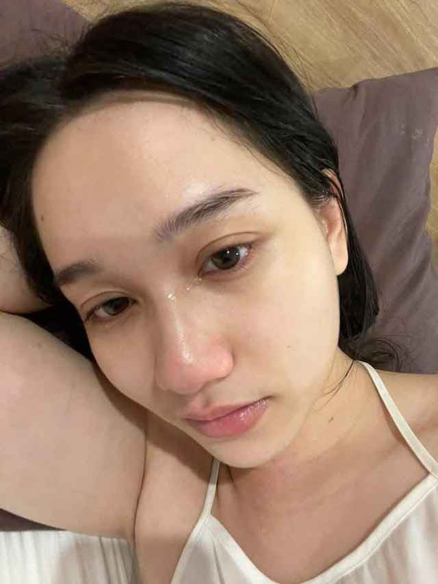 Nữ diễn viên chia sẻ: "Không rõ từ lúc nào trở thành cái lọ thuốc. Hành trình này gian nan vất vả quá mọi người ạ, đôi khi chỉ muốn bỏ cuộc thôi. Nhưng không dám từ bỏ vì tình yêu đời này không cho phép. Mình đang cố gắng hết sức đây mọi người ơi. Da mình là bị rạn do tăng cân đột ngột mọi người ạ...