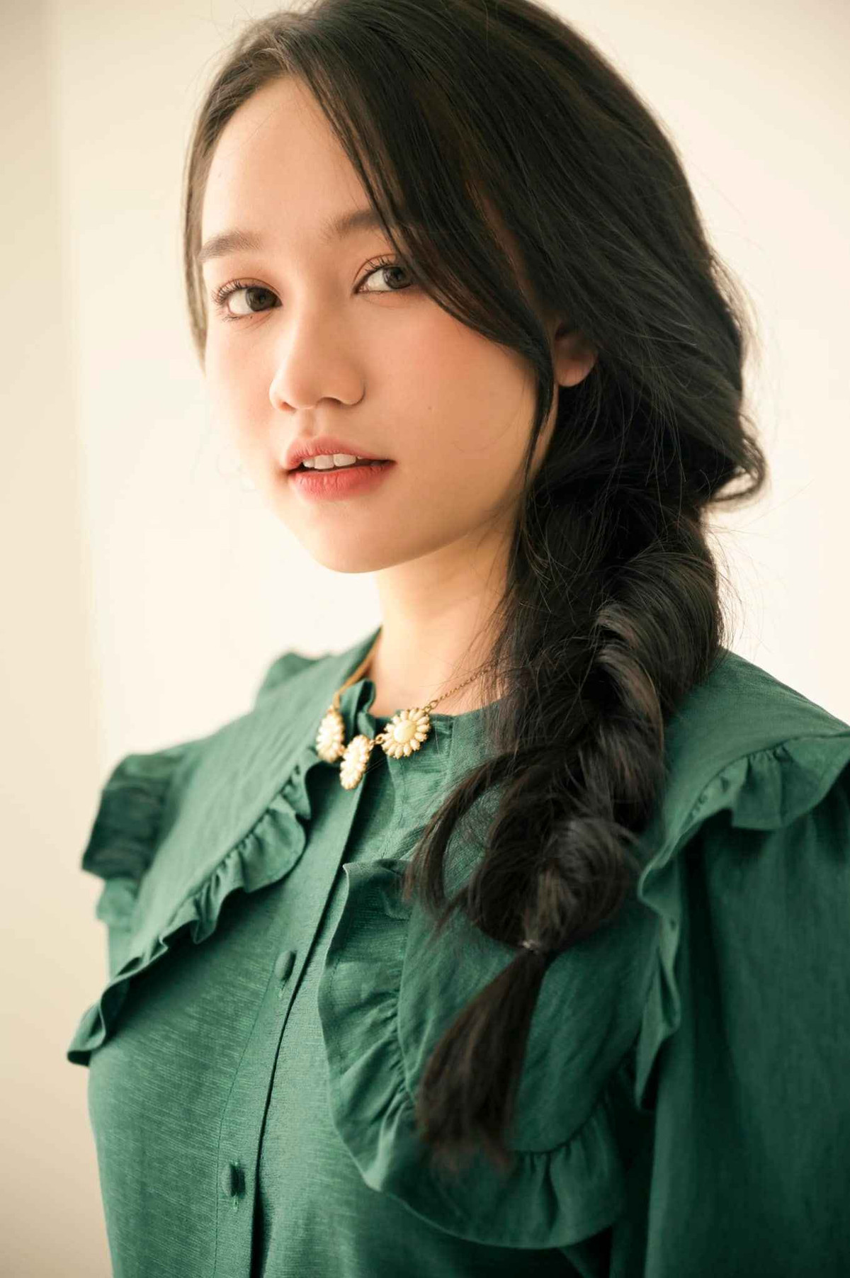 Trị rạn da chích kim đau thấu trời xanh nhưng cũng khá hiệu quả vì nó mờ đi bớt. Tóc mình thì bị rụng, sợ hãi quá ai gặp cũng xót nên phải cắt ngắn đi cho nó mọc lại. Mình đang chấp nhận sự thật là mình bị bệnh". Trúc Anh chia sẻ.