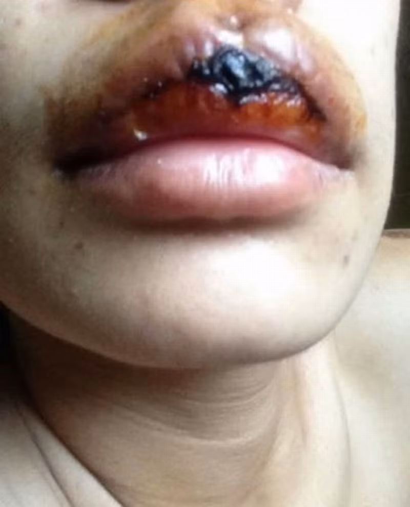 Hiện bài viết về màn phun môi hỏng trên vẫn đang nhận được rất nhiều sự quan tâm và bình luận của dân mạng.