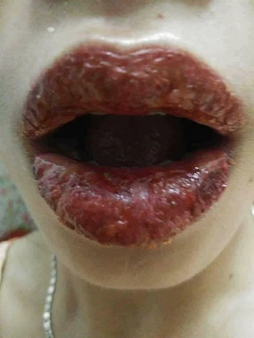 Ở dưới phần bình luận, rất nhiều người bày tỏ sự hoang mang trước màn phun môi hỏng này.