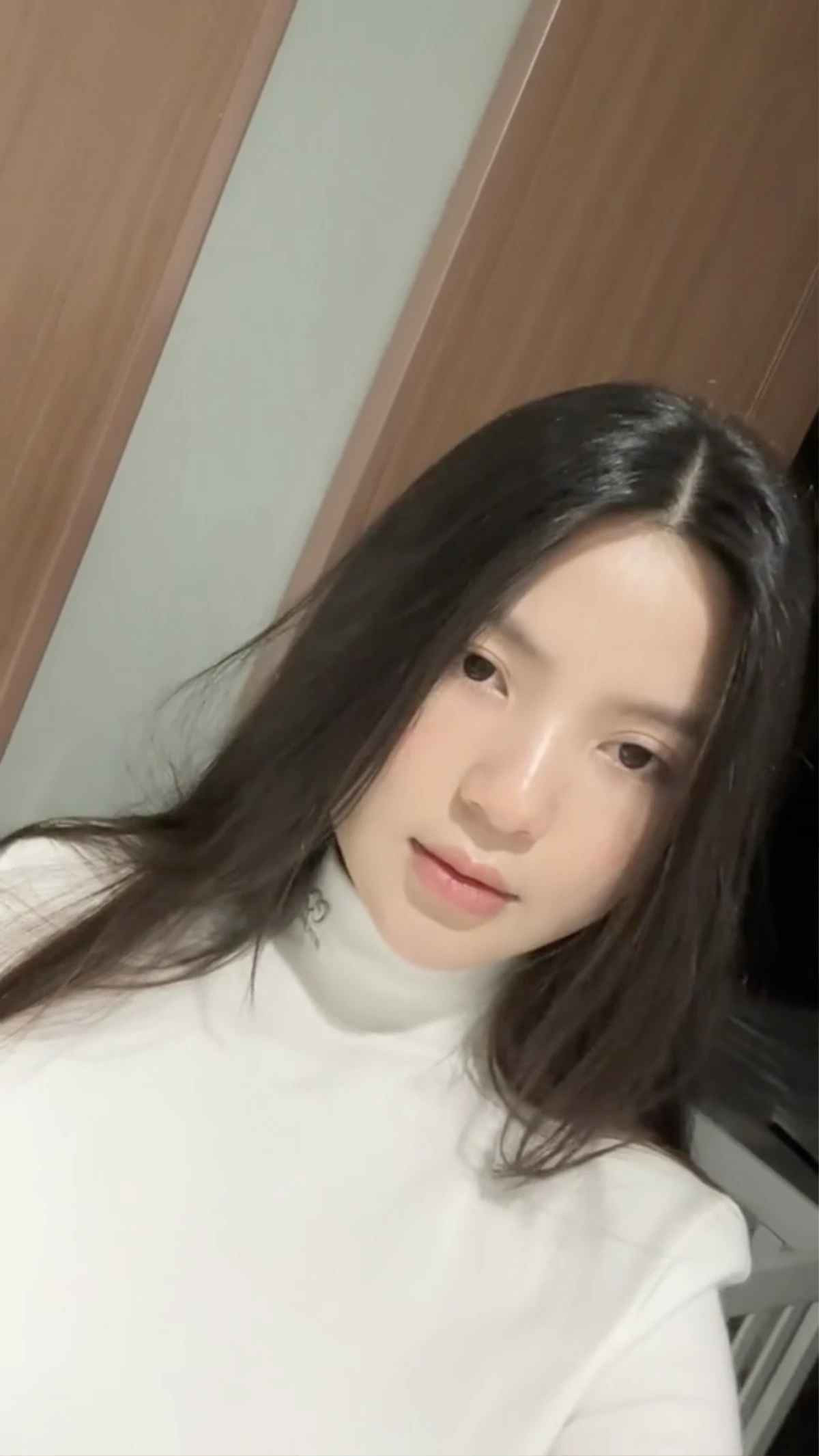 Theo đó, do tác dụng phụ của việc tiêm filter căng bóng môi, đôi môi của Chu Thanh Huyền đã "trề ra", sưng phù, không còn được đẹp như trước đây.