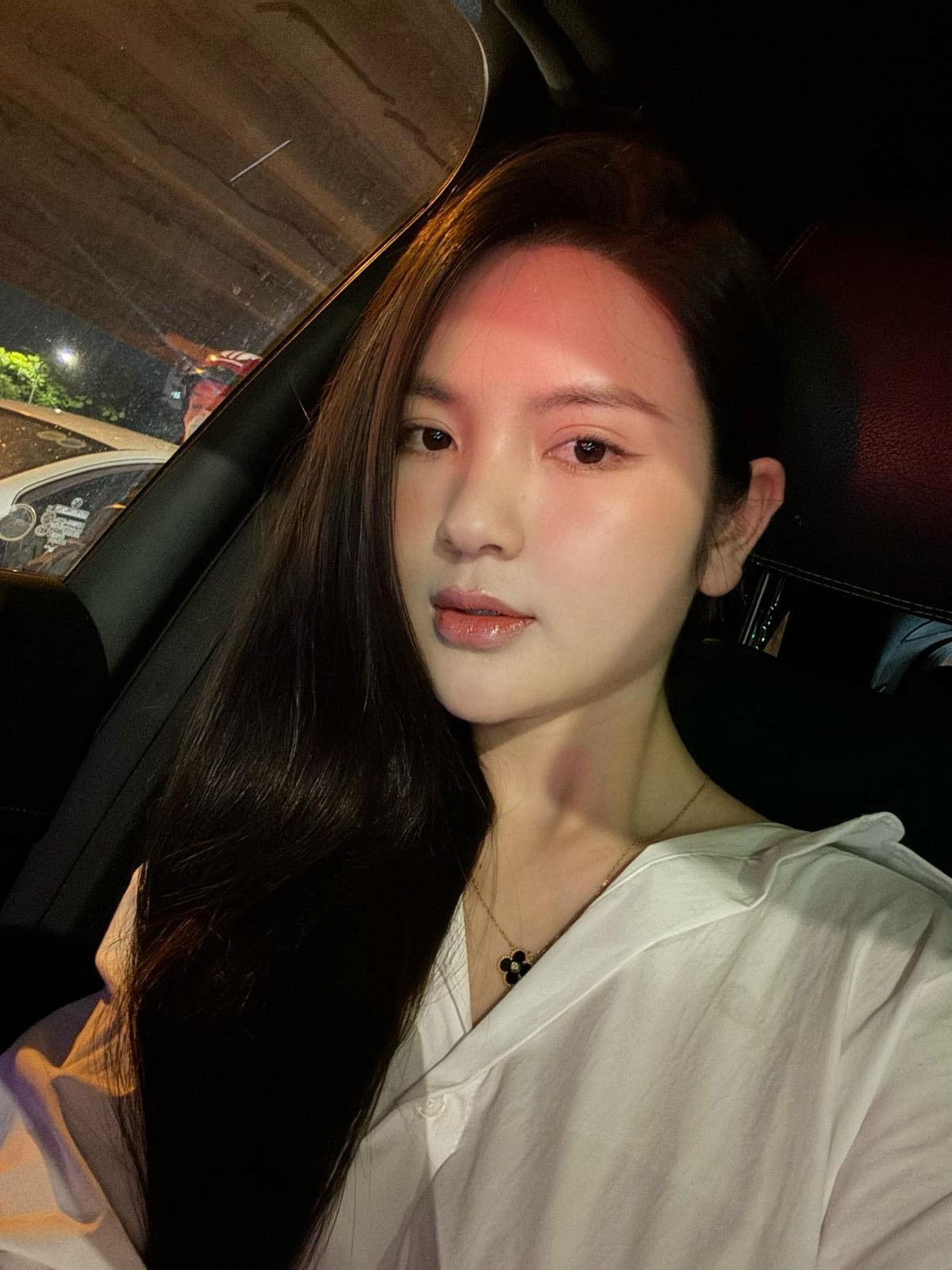 Sau khi tiêm xong, do vừa mới can thiệp thẩm mỹ đã khiến đôi môi của vợ Quang Hải sưng phồng, đến mức nhiều khán giả không nhận ra.