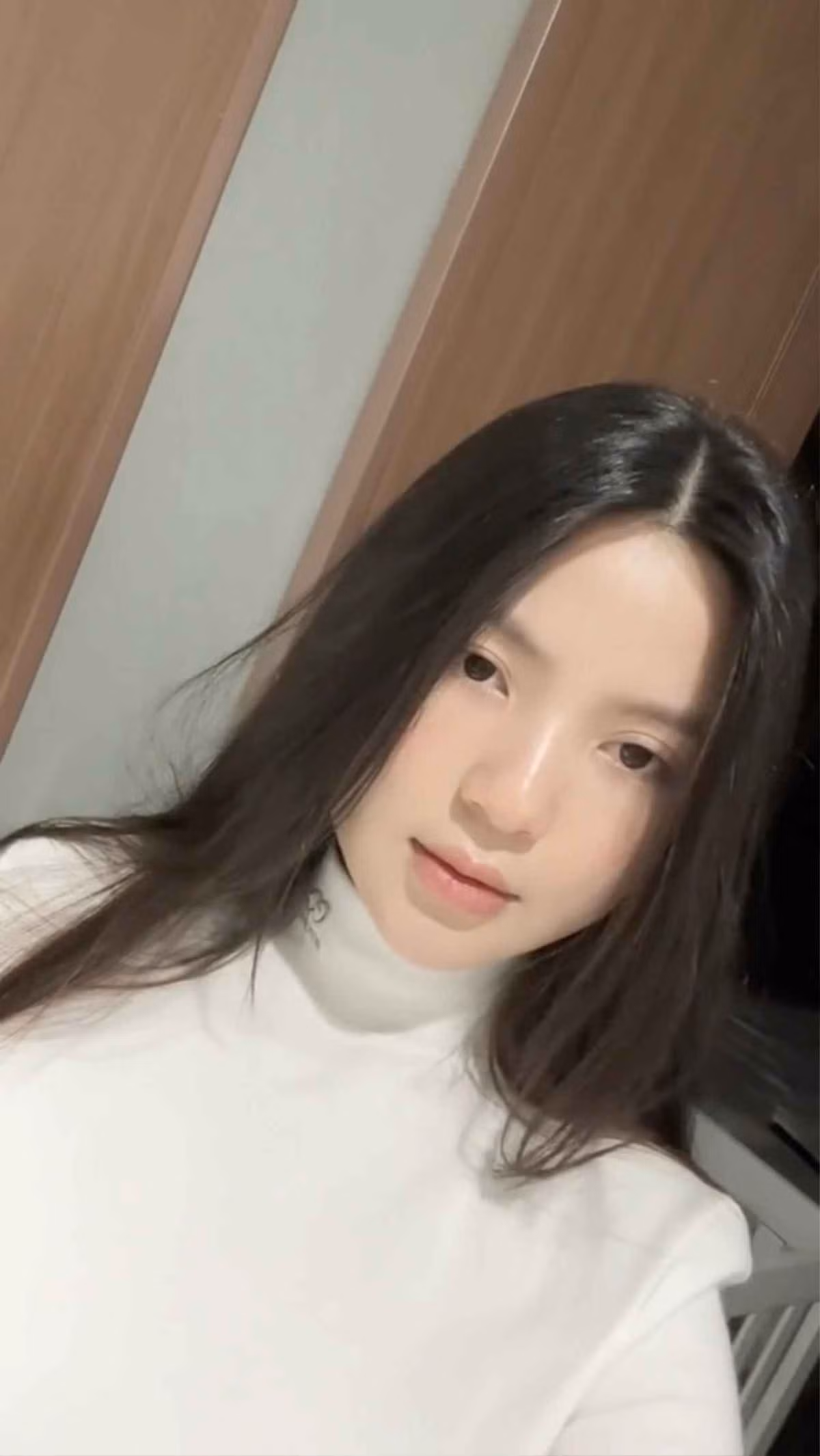 Theo đó, do tác dụng phụ của việc tiêm filter căng bóng môi, đôi môi của Chu Thanh Huyền đã "trề ra", sưng phù, không còn được đẹp như trước đây.