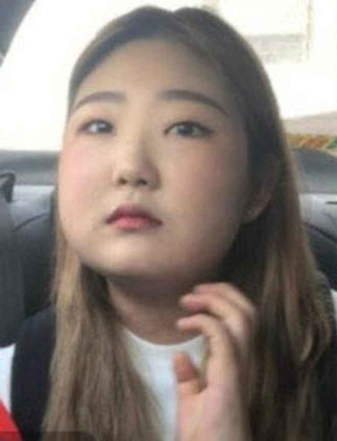 Đỉnh điểm, cân nặng của Choi Joon Hee lên đến 96kg, không đi lại được, phải nhập viện điều trị và tạm dừng việc học.