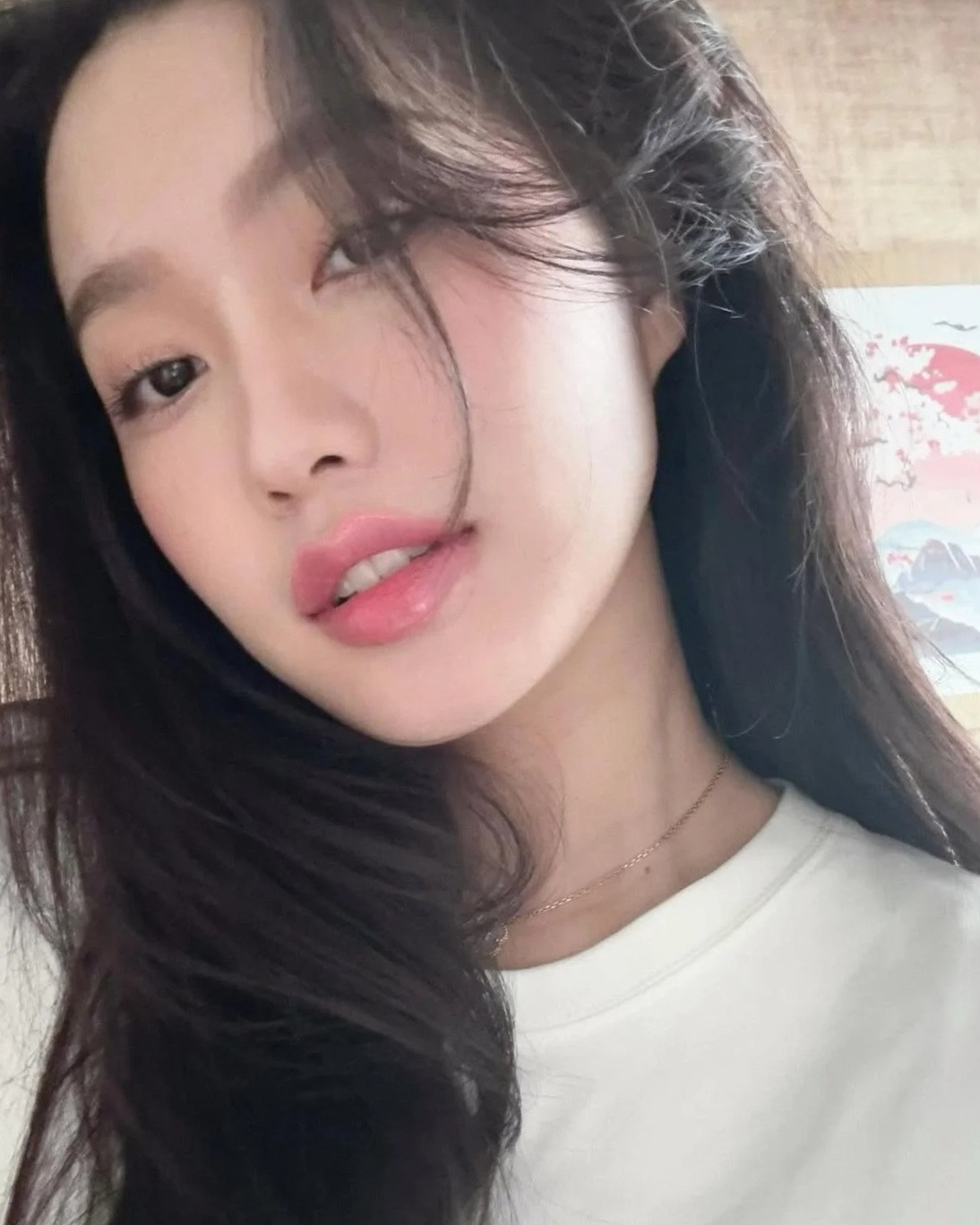 Đây là lần gần nhất bà xã Đoàn Văn Hậu cập nhật tình trạng đôi môi sau khi trải qua thẩm mỹ.