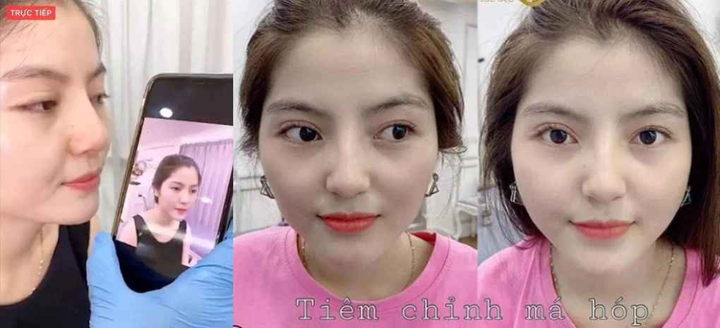 Chu Thanh Huyền từng tìm đến các phương pháp làm đẹp để cải thiện nhan sắc. Cụ thể, cô can thiệp mũi và tiêm chỉnh má hóp để có gương mặt đầy đặn hơn.