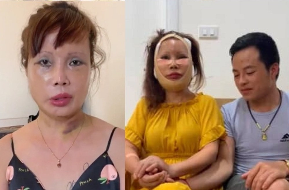 Không chỉ màu da thay đổi mà ngay cả mũi, cằm của chị Thu Sao cũng có sự khác biệt rất lớn. Có lẽ vì vậy nên cô tự tin hơn khi quay clip bên cạnh chồng trẻ.