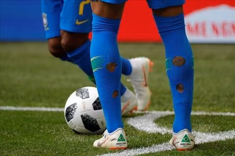 Ở một khía cạnh khác, các chuyên gia y tế nhận định việc đi tất rách sẽ giúp giảm áp lực cơ đùi, hạn chế việc bị chấn thương.