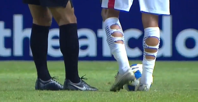 Trước đó, cựu bác sĩ của ĐTQG và U23 Việt Nam, ông Nguyễn Trọng Thủy đã chia sẻ về việc các cầu thủ đi tất rách rằng: "Việc cắt một vài lỗ ở vùng bắp chân sẽ giúp cầu thủ thoải mái hơn khi thi đấu. Tuy nhiên đây cũng chỉ là một giả thiết thôi....