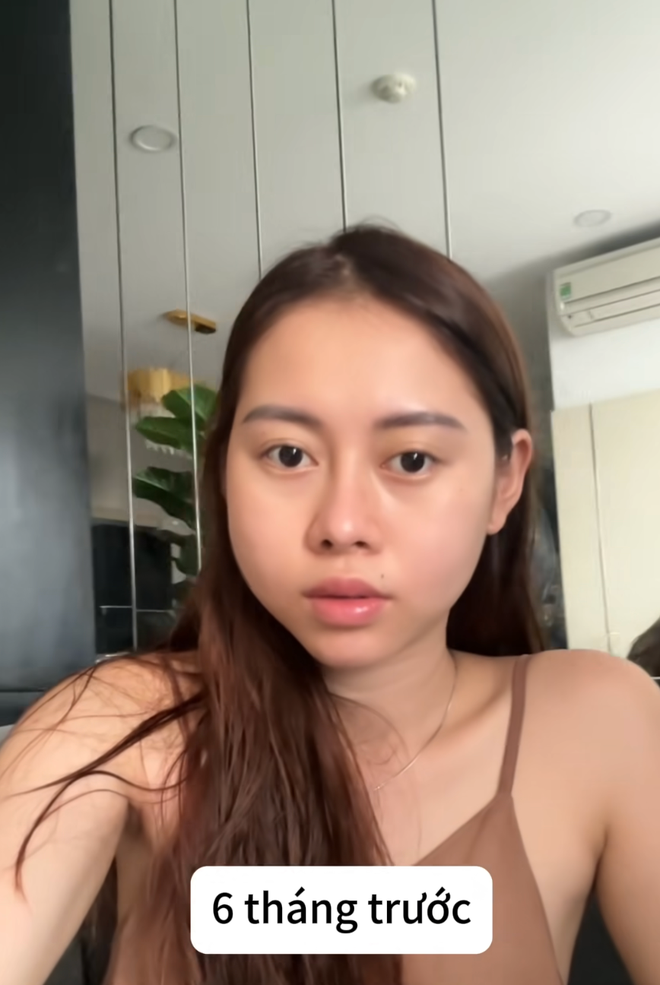 Thời điểm này, Việt Phương Thoa có một người bạn được tài trợ tiêm filler miễn phí vì có một lượng followers nhất định trên MXH, nên cô cũng đã liên hệ với spa thử.