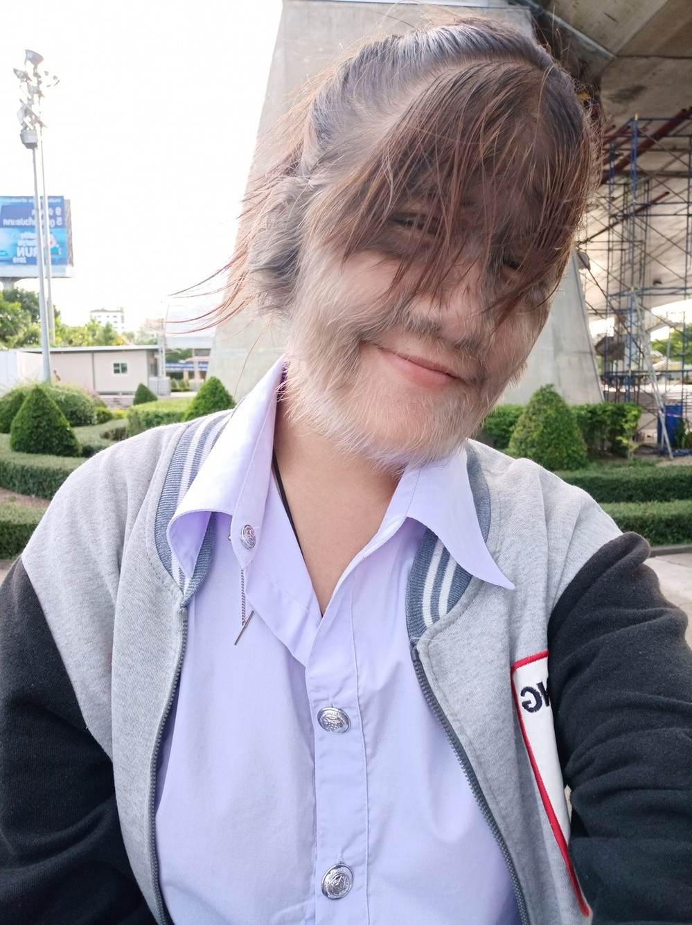 Cô bé Supatra Sasuphan năm nào giờ đây đã trưởng thành, đang ở trong độ tuổi đôi mươi và là sinh viên của trường Đại học Tangtrongchit Commercial ở Bangkok.