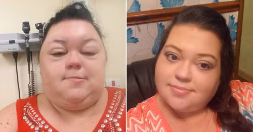 Seraya cho biết mình đã có kinh nghiệm tự nhuộm tóc trong 13 năm và đã quen với việc bị dị ứng. Tuy nhiên không hiểu sao lần này, kết quả lại tệ hại đến vậy khiến cô sợ và không còn tự nhuộm tóc nữa.