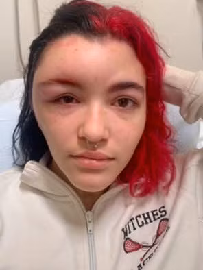 Mới đây, Seraya Ellison (19 tuổi) đã chia sẻ hậu quả khôn lường từ việc nhuộm tóc tại nhà trên tài khoản TikTok @ser.gaya nhanh chóng nhận về sự quan tâm của cộng đồng mạng với hơn 3,5 triệu lượt xem.