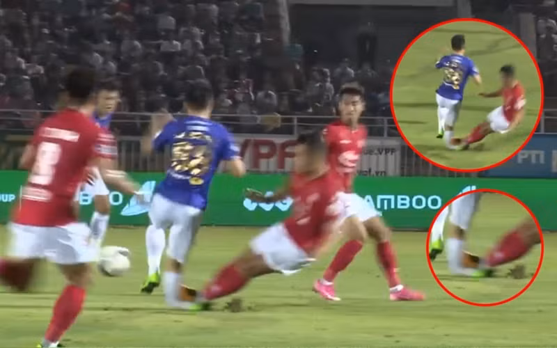 Trong những ngày qua, người hâm mộ bóng đá Việt Nam đã phải trải qua cảm giác từ bàng hoàng, lo lắng cho tới thở phào nhẹ nhõm về tin tức chấn thương của Đỗ Hùng Dũng. Mọi thông tin về anh được cập nhật liên tục trên các phương tiện thông tin đại chúng, các trang mạng xã hội và đều nhận được lượng tương tác rất cao.