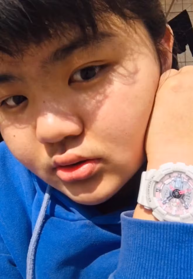 Càng lớn, Vương Nặc càng ý thức được ngoại hình của bản thân khác biệt và kém sắc hơn so với bạn bè. Đặc biệt, tới năm 2 đại học, cô nàng "cảm nắng" một đàn anh hoạt động chung hội sinh viên.