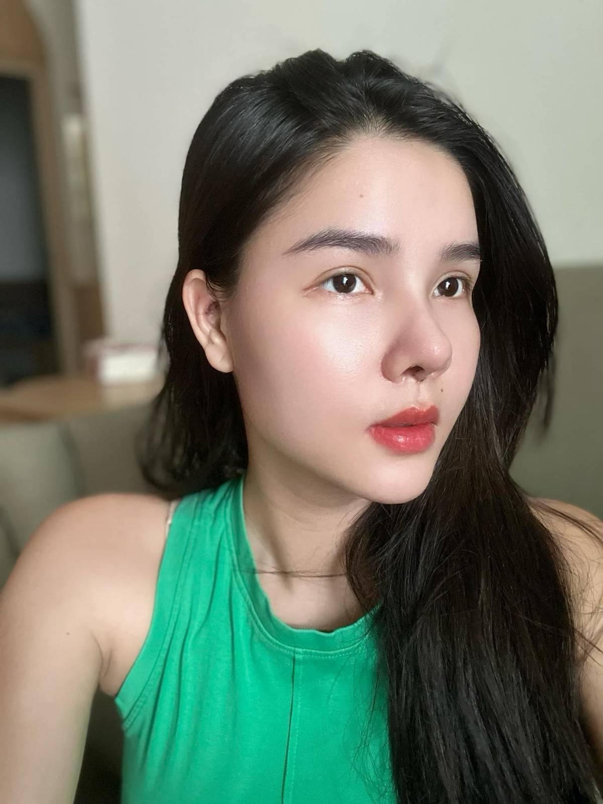 Siêu mẫu Kỳ Hân chia sẻ: "Trộm vía không bị bầm tím hay bầm vàng gì luôn. Phần là bác sĩ mát tay. Phần là do cơ địa mình cũng lành. Mình chưa đến ngày cắt chỉ, và mũi cũng còn sưng".