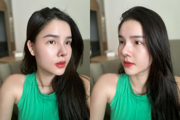 Bài đăng của Kỳ Hân nhanh chóng nhận được nhiều sự quan tâm của của người hâm mộ, họ so sánh hình dạng mũi mới - mũi cũ, cũng như bình luận về chuyện dao kéo của nàng WAG này.