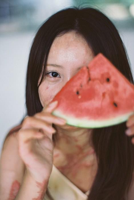 Đáp lại sự từ chối của Châu Nham là sự cuồng nộ bệnh hoạn của Nhữ Khôn. Hắn bám theo cô ở khắp nơi khiến cuối cùng gia đình phải chuyển trường cho nữ người mẫu trẻ 9X này.