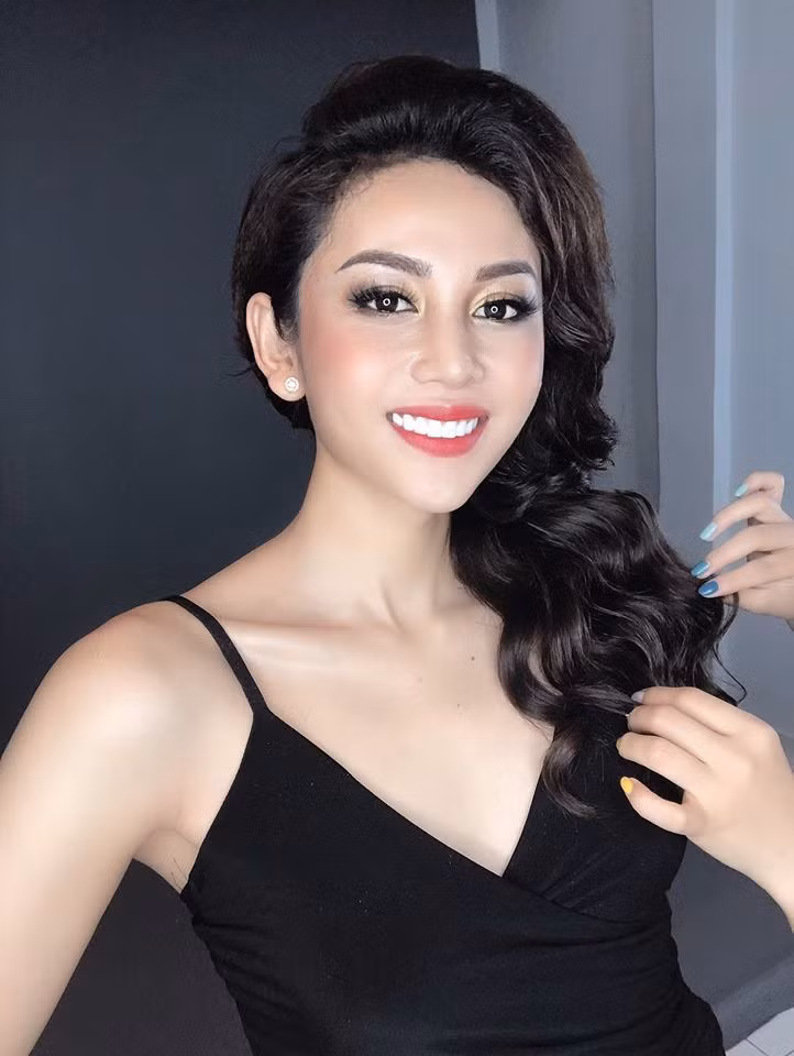 Sau khi chuyển giới, nhan sắc của Trung Kiên còn khiến CĐM xôn xao hơn bởi gương mặt góc cạnh, sắc sảo, đường nét cân đối khiến "con gái còn mê".