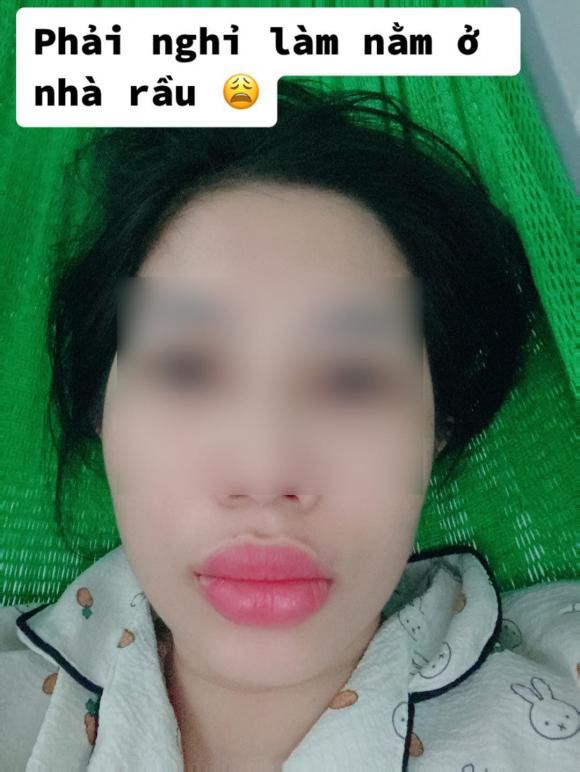 Tuy nhiên, việc tiêm môi cũng là "con dao hai lưỡi" vì bên cạnh những ưu điểm và lợi thế nổi bật đó thì cũng còn những rủi ro tiềm ẩn nếu như không lựa chọn đúng người thực hiện kỹ thuật có trình độ, tay nghề và giàu kinh nghiệm.