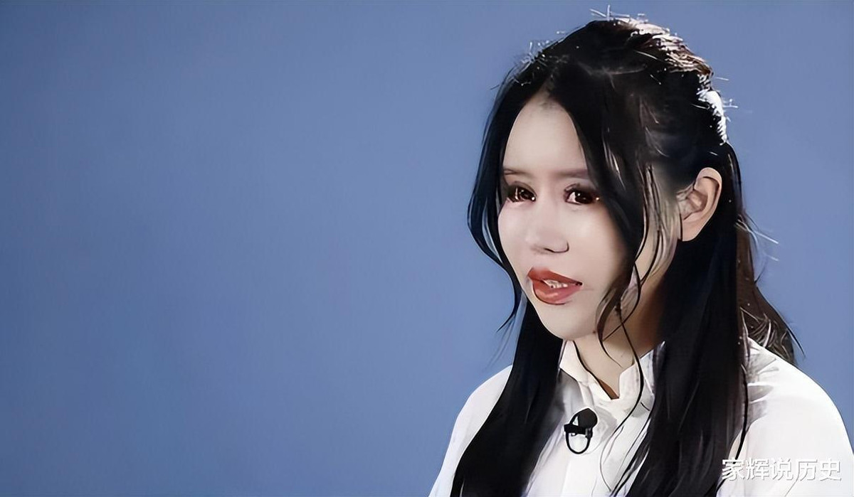 Bây giờ, do hút mỡ quá nhiều, da toàn thân chảy xệ, xương cốt chắp vá chạm vào dây thần kinh, khiến từ nay về sau Chu Sở Na không thể biểu cảm quá mức hoặc tự nhiên được nữa.