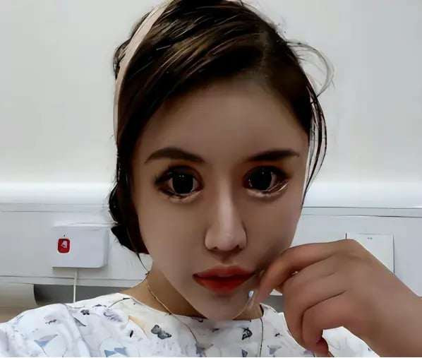 Đối mặt với những lời chế giễu của các bạn cùng lớp, Chu Sở Na quyết định phẫu thuật thẩm mỹ. Sau lần phẫu thuật thẩm mỹ đầu tiên, cô cảm thấy thái độ của những người xung quanh đã thay đổi 180 độ, và cô cho rằng sự thay đổi này là do ngoại hình xinh đẹp của mình.