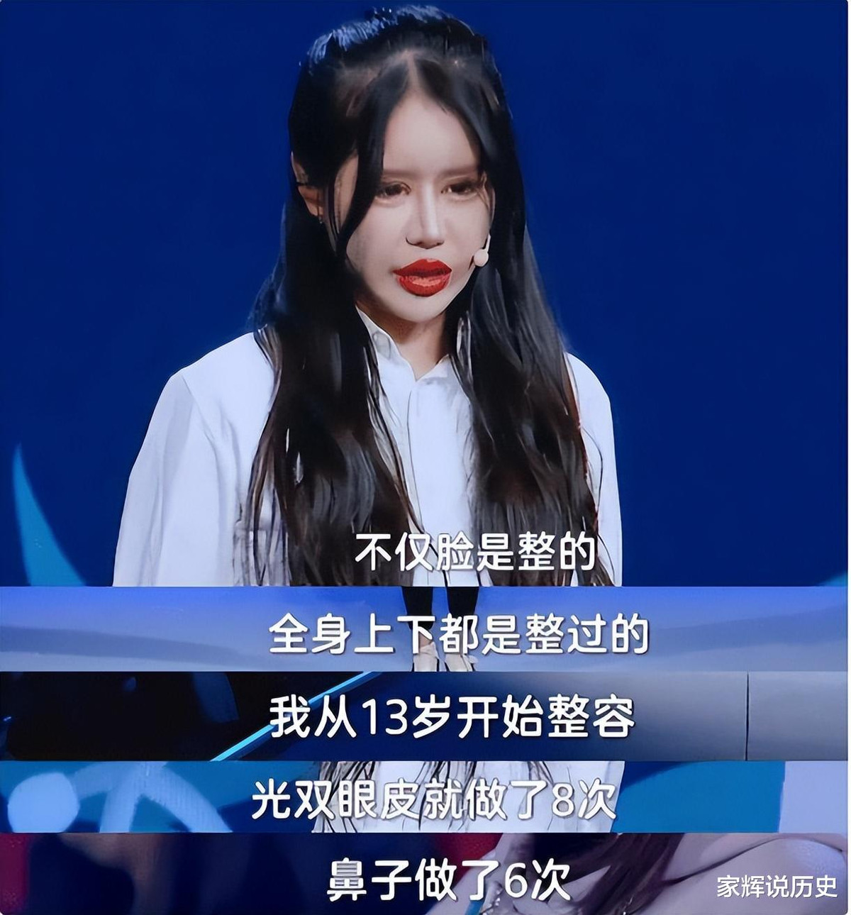 Có lần thời gian hồi phục phẫu thuật thẩm mỹ đặc biệt dài, Chu Sở Na chọn cách ở nhà, lướt mạng xã hội, vào diễn đàn cộng đồng phẫu thuật thẩm mỹ tham khảo.