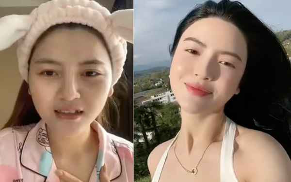 Về phần nàng WAG, Thanh Huyền từng can thiệp mũi và tiêm chỉnh má để có vẻ ngoài như mong muốn. Ngoài ra nhìn những hình ảnh của hot girl quê Sơn Tây ngày xưa cũng có thể thấy cô nàng đã can thiệp răng, 2 chiếc răng khểnh xinh xinh không còn nữa.