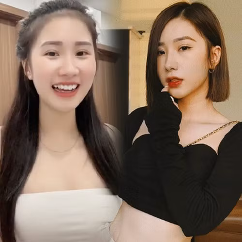 Sự thay đổi của Tiểu Hý từng được dân mạng đăng ảnh so sánh.