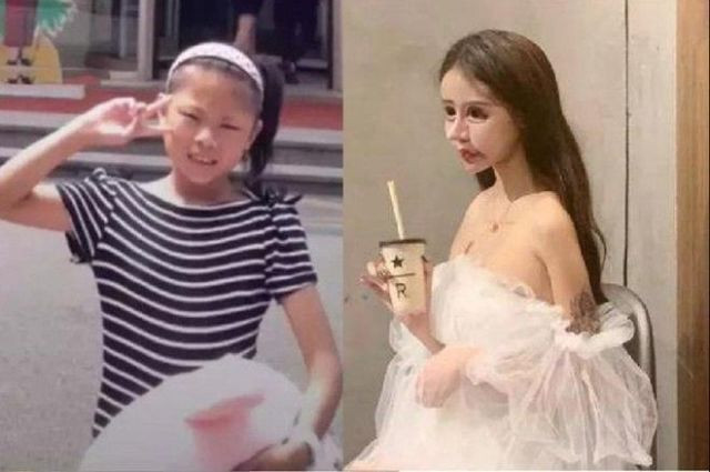 Tiểu Z Nana nổi tiếng trên MXH nhờ câu chuyện "đại phẩu" gương mặt của mình.