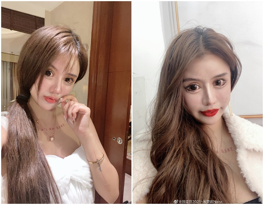 Với vô số lần phẫu thuật lớn nhỏ đã giúp Tiểu Z Nana ngày càng trở nên nổi tiếng nhưng bên cạnh đó cũng có rất nhiều lời chỉ trích.