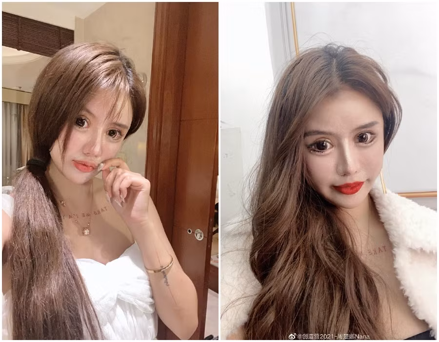 Với vô số lần phẫu thuật lớn nhỏ đã giúp Tiểu Z Nana ngày càng trở nên nổi tiếng nhưng bên cạnh đó cũng có rất nhiều lời chỉ trích.