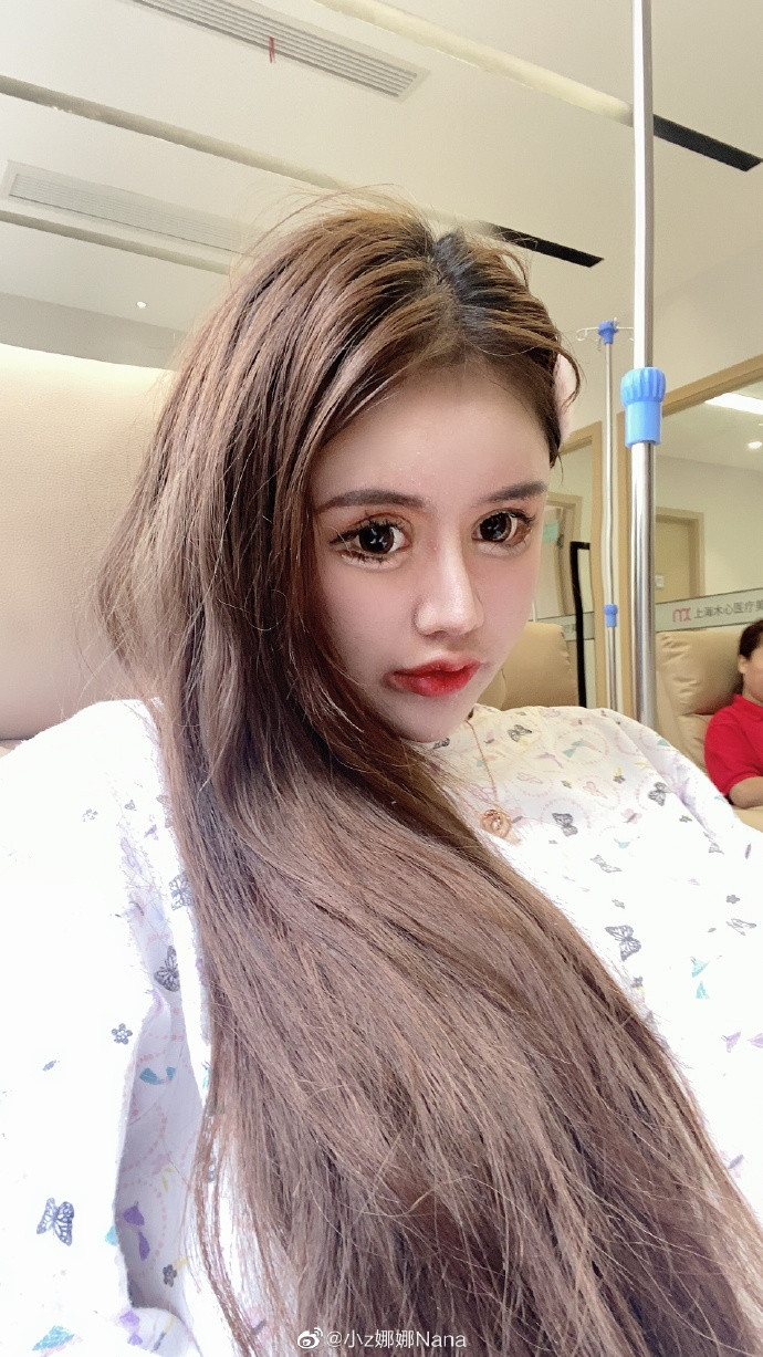 Hầu như trên khắp cơ thể của hot girl sinh năm 2004 đều có dấu vết “dao kéo”. Do quá mải mê “lột xác”, Tiểu Z Nana không thể đến trường học.