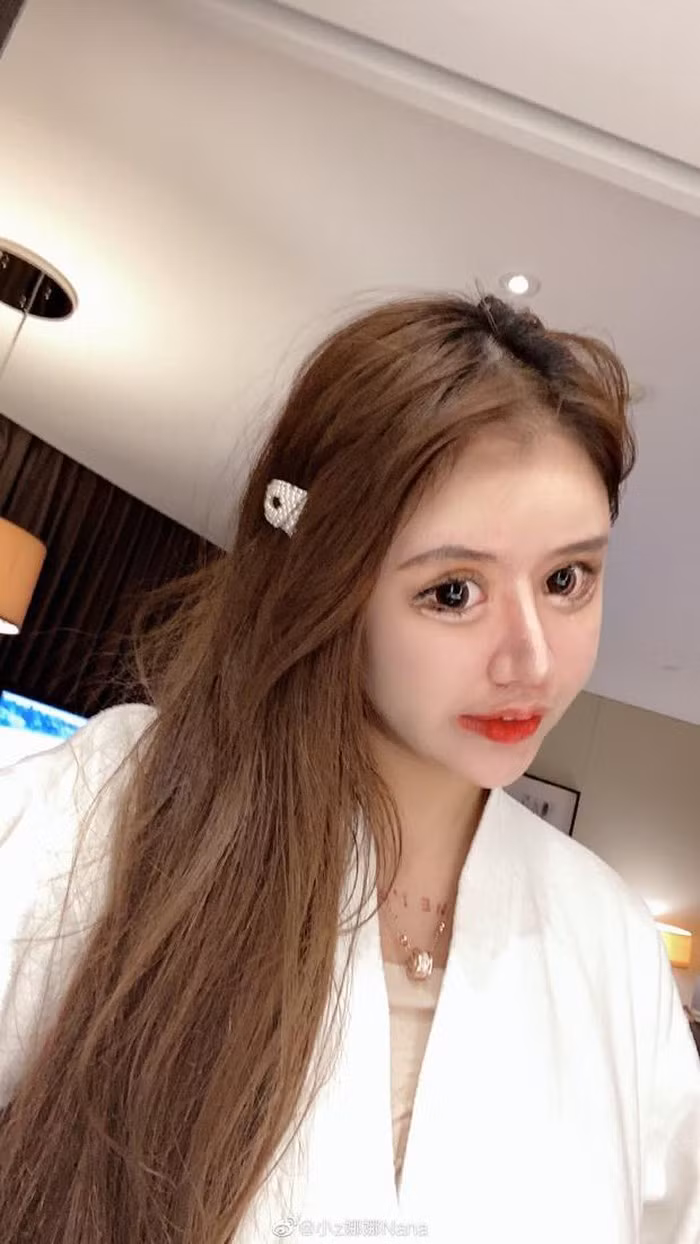 Theo chia sẻ của Tiểu Z Nana, cô đã bắt đầu "dấn thân" vào con đường chỉnh sửa dung nhan từ năm 13 tuổi.