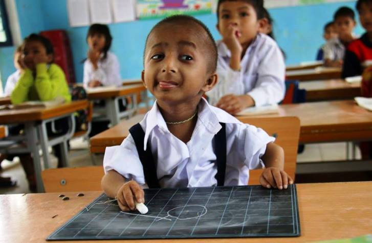 Dù mắc bệnh lý trên cơ thể ngay từ khi mới sinh ra, nhưng trên gương mặt K'Rể không bao giờ vắng bóng nụ cười. Em để lại ấn tượng với bạn bè, gia đình và tất cả mọi người bằng nghị lực sống và luôn khát vọng được yêu thương, được đi học.