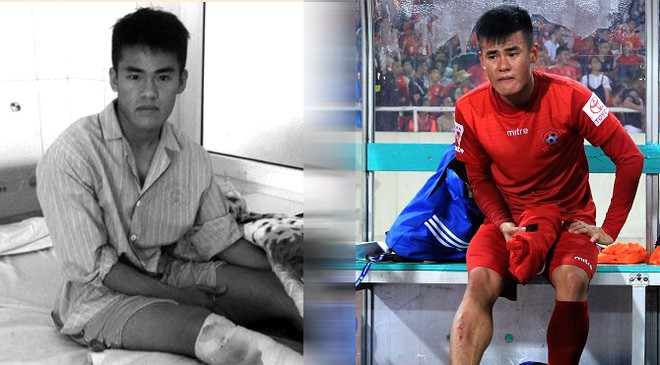 Đình Đồng bị phạt 20 triệu đồng, bị cấm thi đấu 6 tháng. Ngoài ra, hậu vệ của SLNA phải thanh toán toàn bộ các chi phí chữa trị chấn thương cho Nguyễn Anh Hùng của CLB Hùng Vương An Giang.