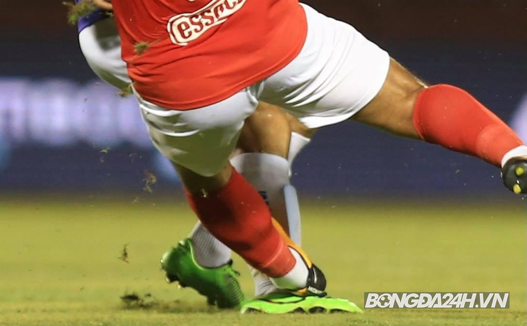 Sau pha vào bóng của Hoàng Thịnh, Đỗ Hùng Dũng bị gẫy chân. Cụ thể, theo chẩn đoán tại bệnh viện, cầu thủ bên phía Hà Nội FC gãy xương chày và xương mác. Ảnh: Bongda24.vn