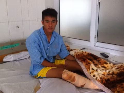 Kết quả chụp phim cho thấy, Anh Hùng bị gãy xương ống chân.