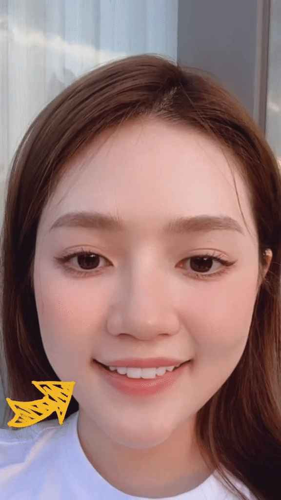 Mới đây, An Vy bất ngờ chia sẻ bản thân bị liệt dây thần kinh một bên mặt. Theo đó, cô nàng để ý thấy một bên má trái của mình bị hạ hơn so với má bên phải. Tổng thể khuôn mặt nhìn bị lệch, có phần đơ cứng nhẹ.